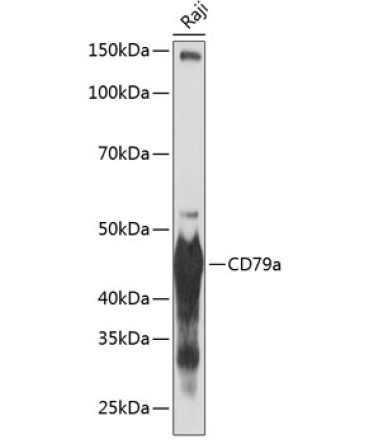 CD79a Rabbit Monoclonal Antibody