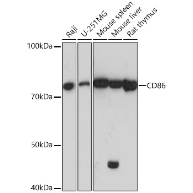 CD86 Rabbit Monoclonal Antibody
