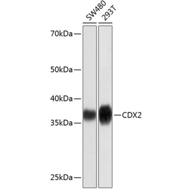 CDX2 Rabbit Monoclonal Antibody [KD Validated]