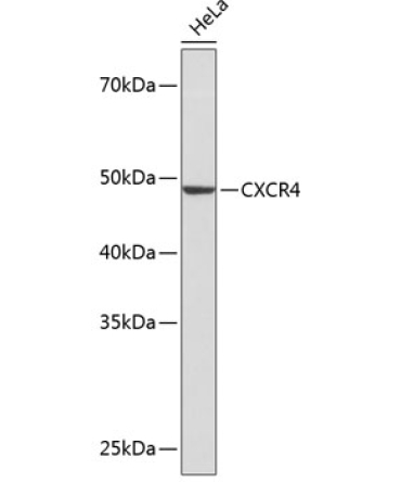 CXCR4 Rabbit Monoclonal Antibody
