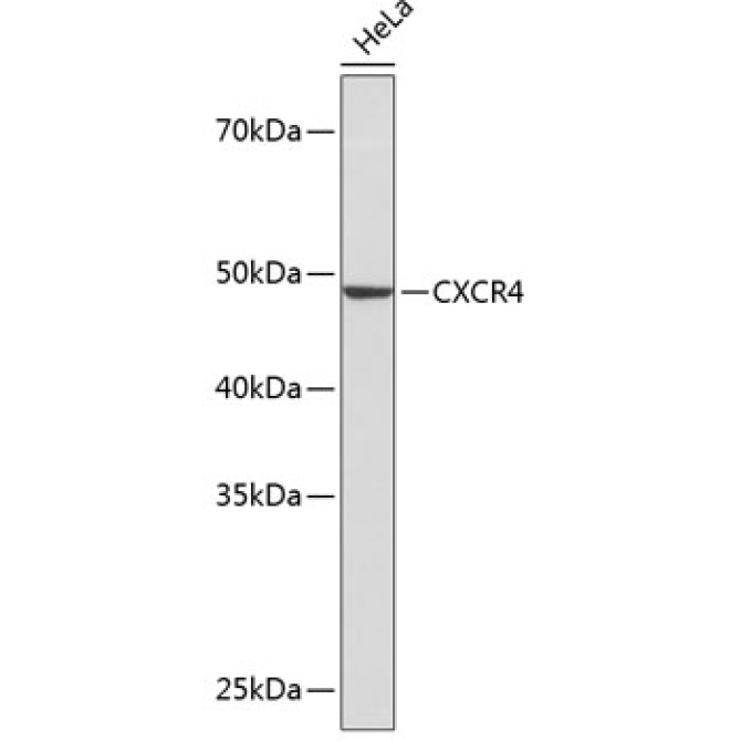 CXCR4 Rabbit Monoclonal Antibody