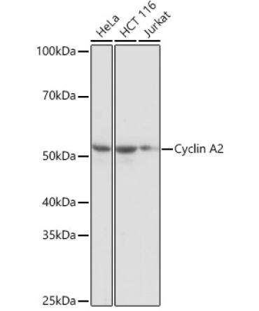 Cyclin A2 Rabbit Monoclonal Antibody