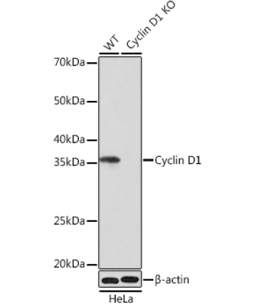 Cyclin D1 Rabbit Monoclonal Antibody [KO Validated]