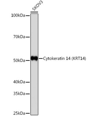 Cytokeratin 14 (KRT14) Rabbit Monoclonal Antibody
