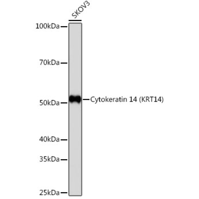 Cytokeratin 14 (KRT14) Rabbit Monoclonal Antibody