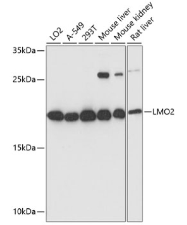 LMO2 Rabbit Polyclonal Antibody