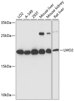 LMO2 Rabbit Polyclonal Antibody