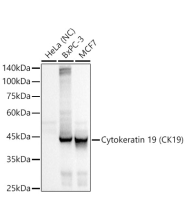 Cytokeratin 19 (CK19) Rabbit Monoclonal Antibody
