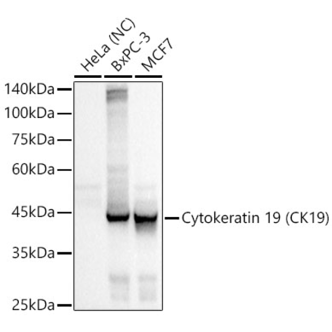 Cytokeratin 19 (CK19) Rabbit Monoclonal Antibody