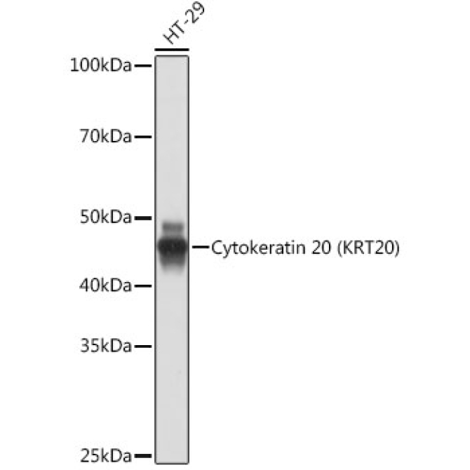 Cytokeratin 20 (CK20) Rabbit Monoclonal Antibody