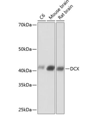 Doublecortin Rabbit Monoclonal Antibody