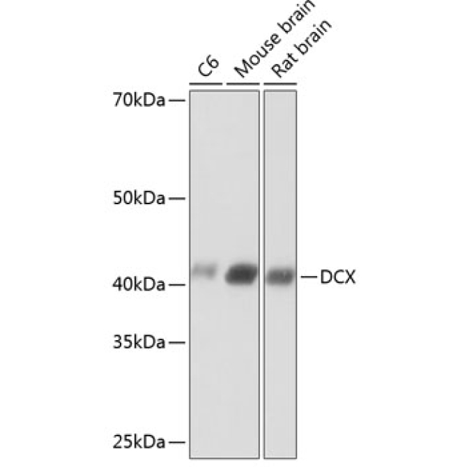 Doublecortin Rabbit Monoclonal Antibody