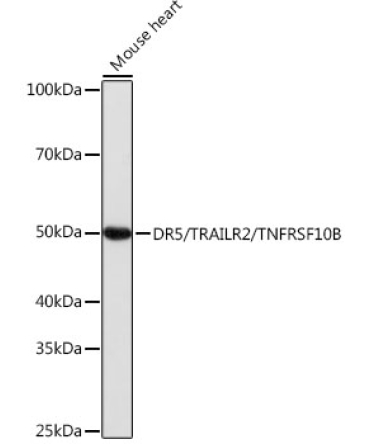 DR5/TRAILR2/TNFRSF10B Rabbit Monoclonal Antibody