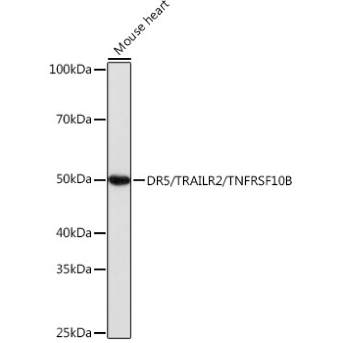 DR5/TRAILR2/TNFRSF10B Rabbit Monoclonal Antibody