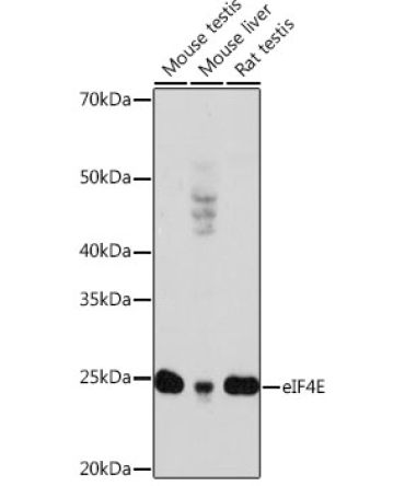 eIF4E Rabbit Monoclonal Antibody