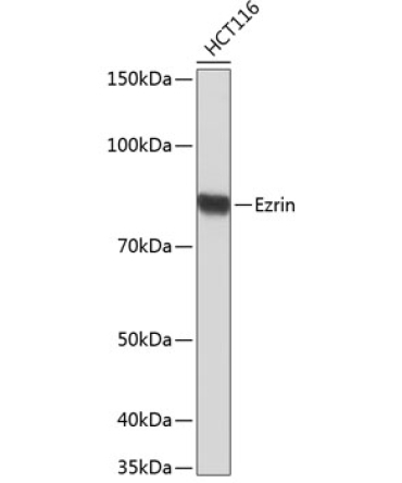 Ezrin Rabbit Monoclonal Antibody