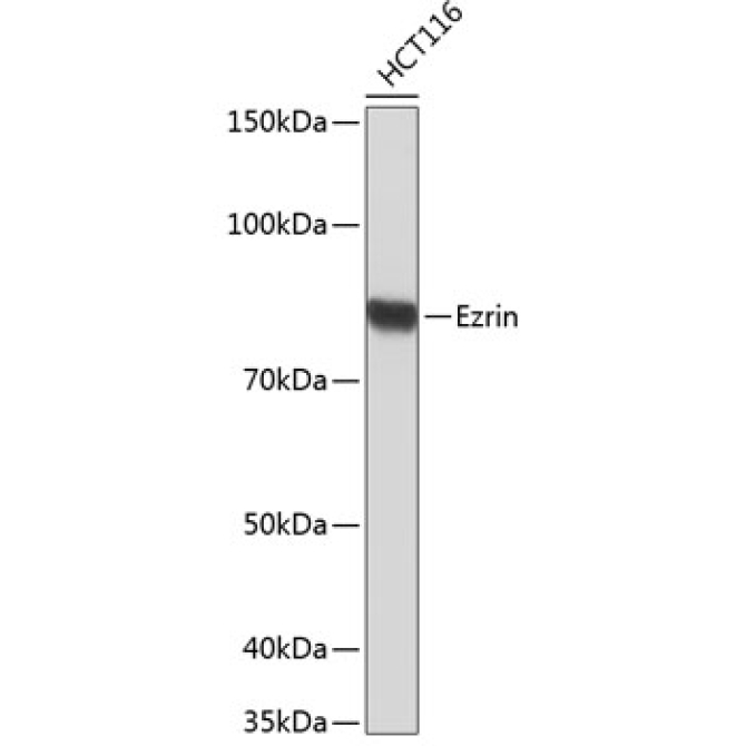 Ezrin Rabbit Monoclonal Antibody