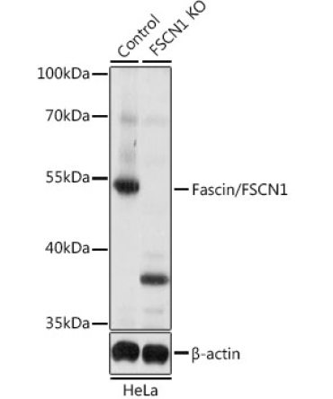 Fascin/FSCN1 Rabbit Polyclonal Antibody [KO Validated]