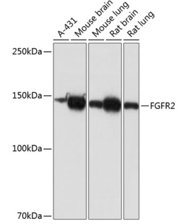 FGFR2 Rabbit Monoclonal Antibody [KO Validated]