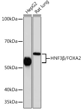 HNF3Beta/FOXA2 Rabbit Monoclonal Antibody