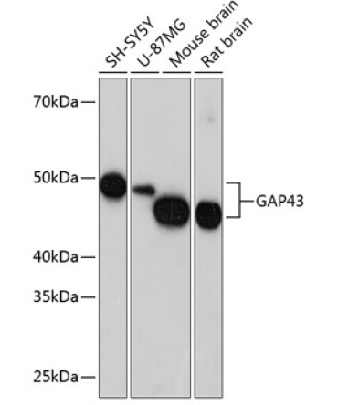GAP43 Rabbit Monoclonal Antibody