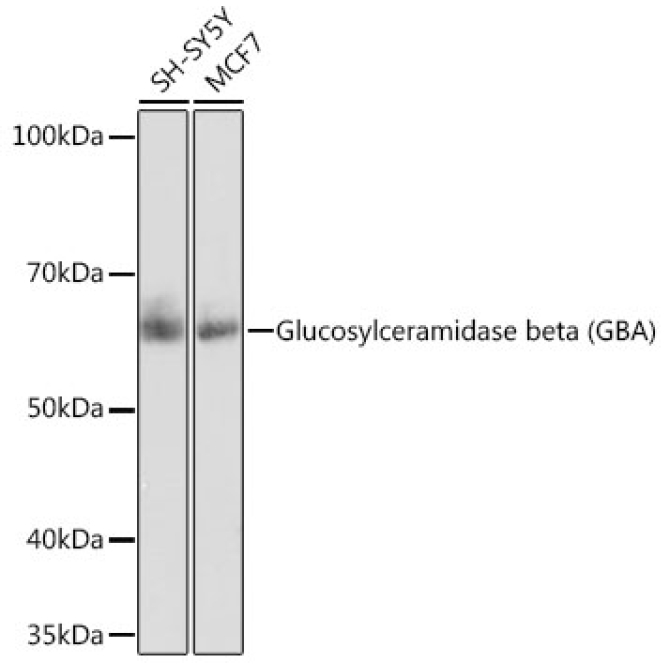 Glucosylceramidase beta (GBA) Rabbit Monoclonal Antibody