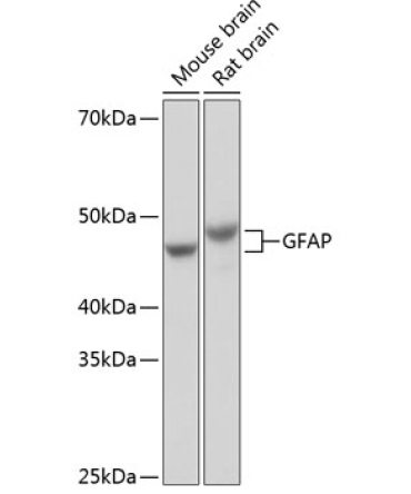 GFAP Rabbit Monoclonal Antibody