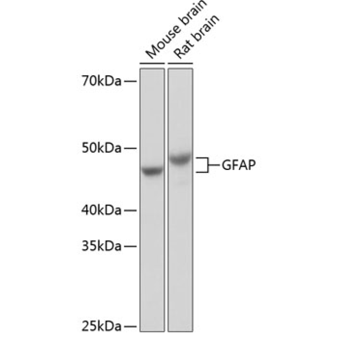 GFAP Rabbit Monoclonal Antibody