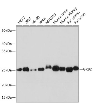 GRB2 Rabbit Monoclonal Antibody