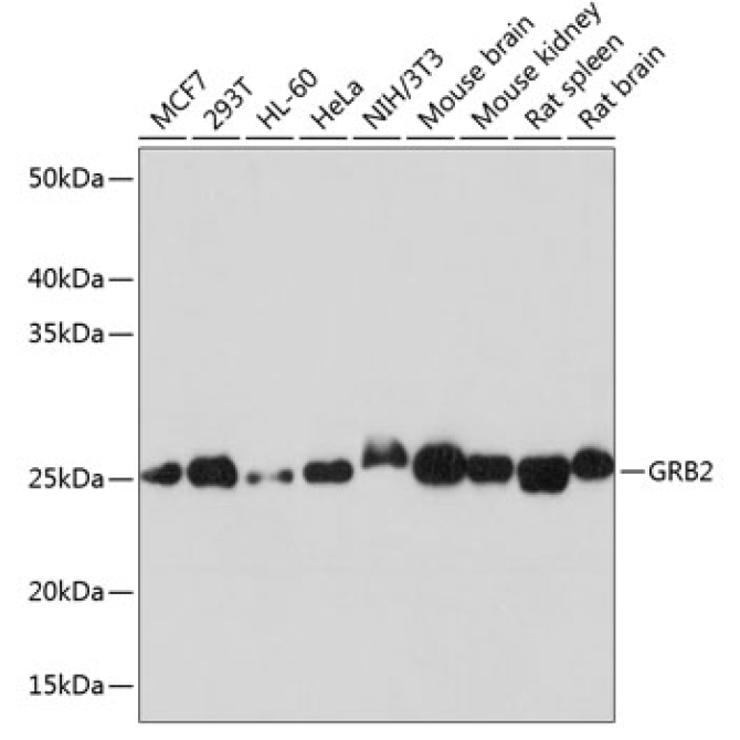 GRB2 Rabbit Monoclonal Antibody