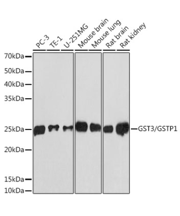 GST3/GSTP1 Rabbit Monoclonal Antibody