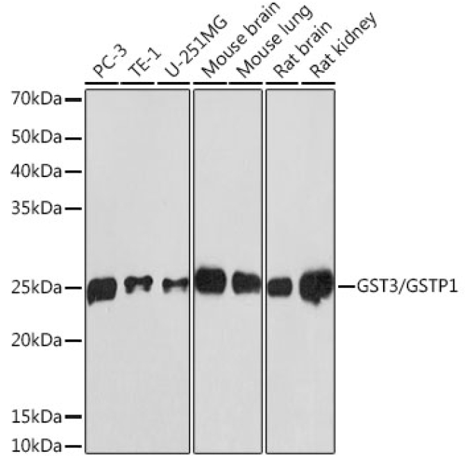 GST3/GSTP1 Rabbit Monoclonal Antibody