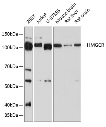 HMGCR Rabbit Monoclonal Antibody