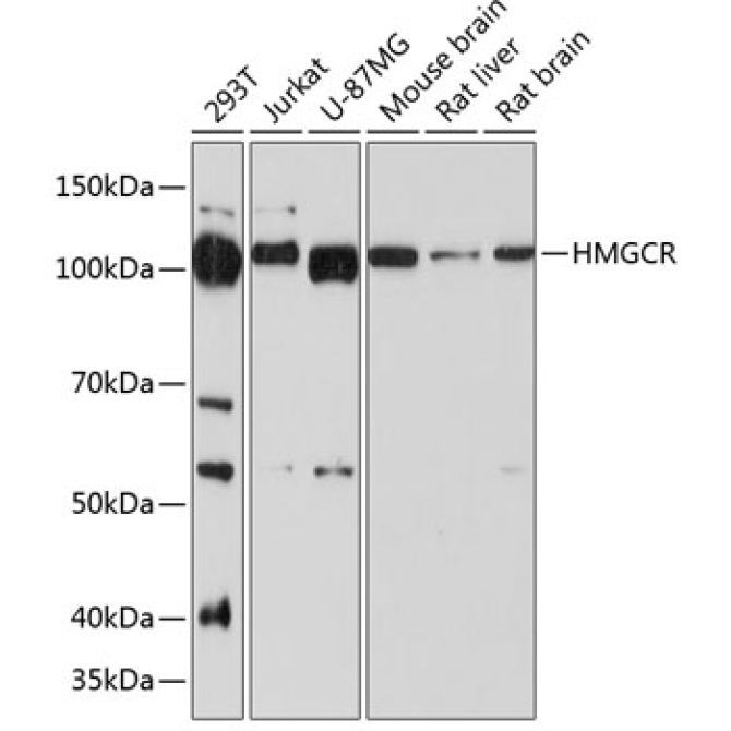 HMGCR Rabbit Monoclonal Antibody