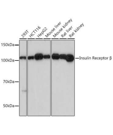 Insulin Receptor Rabbit Monoclonal Antibody
