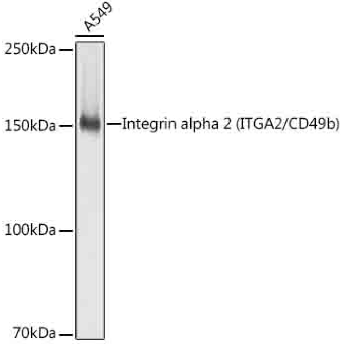 Integrin alpha 2 (ITGA2/CD49b) Rabbit Monoclonal Antibody [KO Validated]