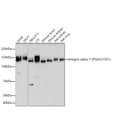 Integrin alpha V (ITGAV/CD51) Rabbit Monoclonal Antibody