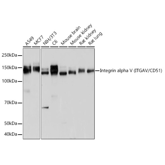 Integrin alpha V (ITGAV/CD51) Rabbit Monoclonal Antibody