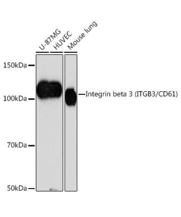 Integrin beta 3 (ITGB3/CD61) Rabbit Monoclonal Antibody