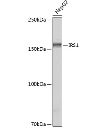 IRS1 Rabbit Monoclonal Antibody