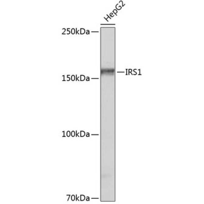 IRS1 Rabbit Monoclonal Antibody