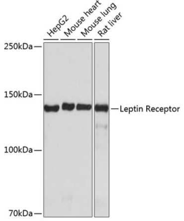 Leptin Receptor Rabbit Monoclonal Antibody