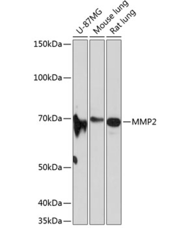 MMP2 Rabbit Monoclonal Antibody