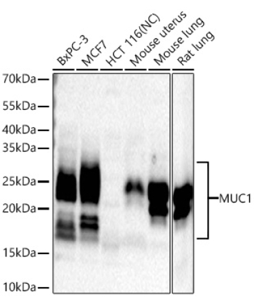 MUC1 Rabbit Monoclonal Antibody
