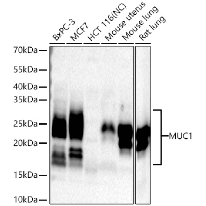 MUC1 Rabbit Monoclonal Antibody