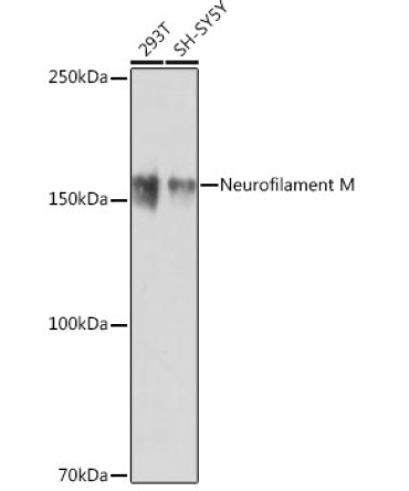 Neurofilament M Rabbit Monoclonal Antibody