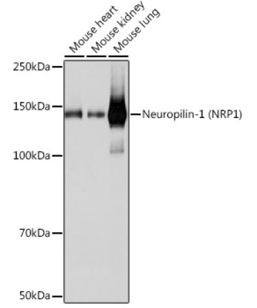 Neuropilin-1 (NRP1) Rabbit Monoclonal Antibody