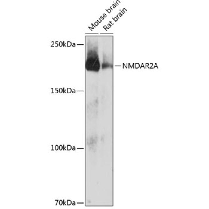 NMDAR2A Rabbit Monoclonal Antibody
