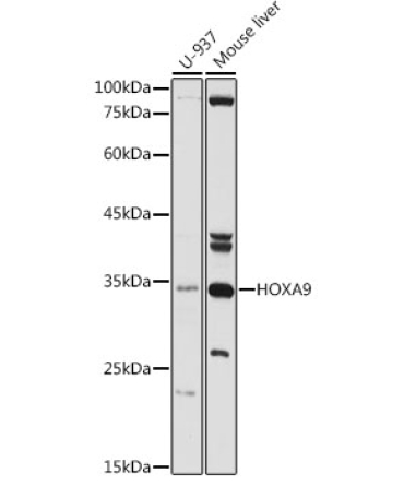 HOXA9 Rabbit Polyclonal Antibody