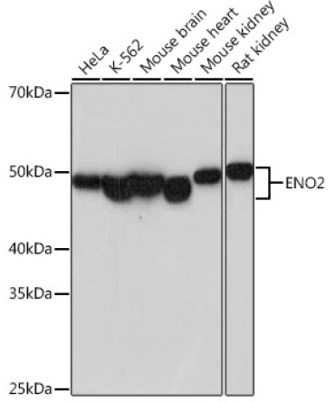 ENO2 Rabbit Monoclonal Antibody